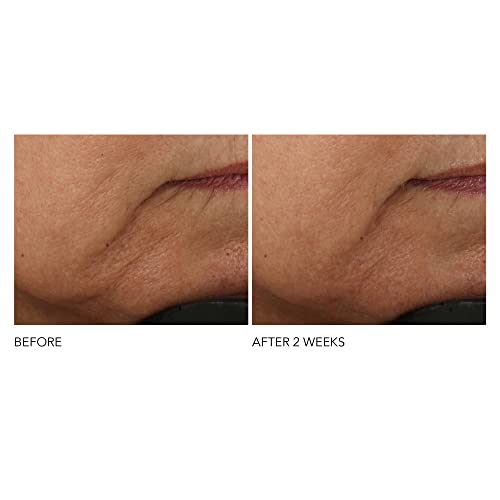 Dr Dennis Gross Advanced Retinol and Ferulic Intense Wrinkle - Product Imagery