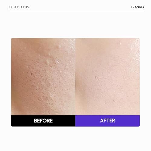FRANKLY Closer Serum | Pore Minimizer Serum | 1.01 fl oz - Product Imagery