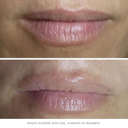 Bioelements Collagen Rehab - 1.7 fl oz - Face & Lip Mask for - Product Imagery