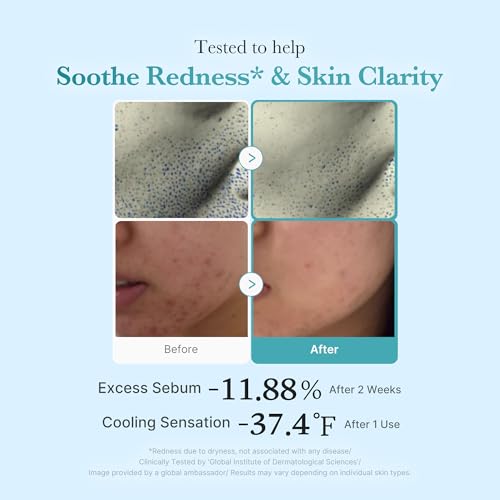 medicube Azelaic Acid Niacinamide Clarifying Toner - Product Imagery