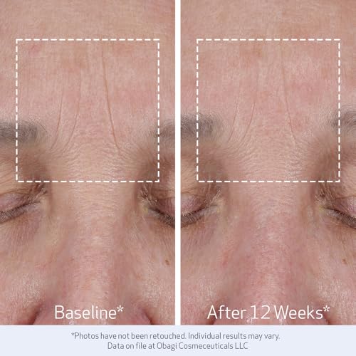 Obagi ELASTIderm Lift Up & Sculpt Facial Moisturizer – - Product Imagery