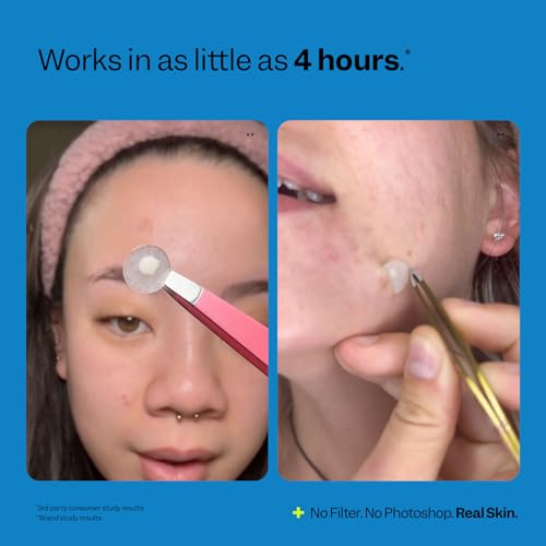Peach Slices - Acne Spot Dots (60 ct) - Hydrocolloid Pimple - Product Imagery