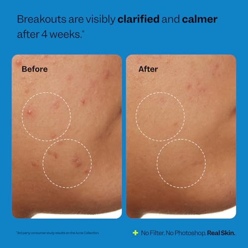 Peach Slices - Acne Clarifying Cleanser (4.05 oz) - 2% Salicylic - Product Imagery