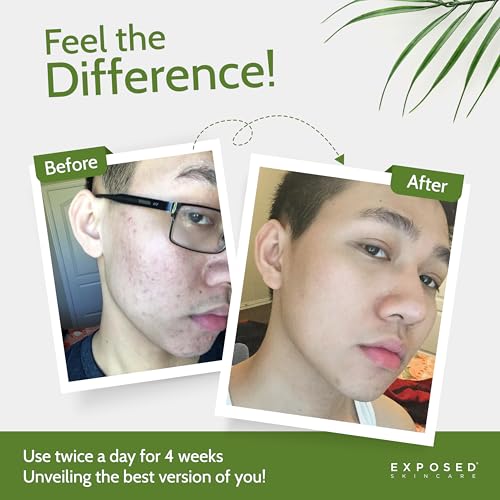 Exposed Skin Care Moisture Complex Oil-Free Daily Face - Product Imagery