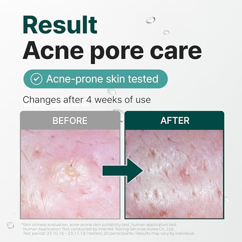 9 Serum for Calming, Hydrating, and Barrier-Strengthening with - Product Imagery