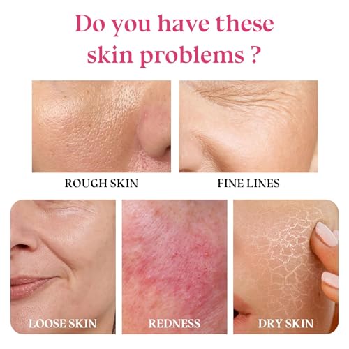 Skin Care Set-Travel Skincare Kit-Collagen Sakura Set with - Product Imagery