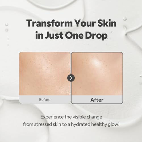 TIRTIR SOS Serum - Radiant Glow Boosting Face Serum - Plumping, - Product Imagery