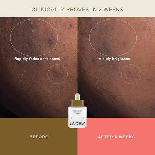 EADEM Dark Spot Remover Serum for Face Infused with Vitamin C & - Product Imagery