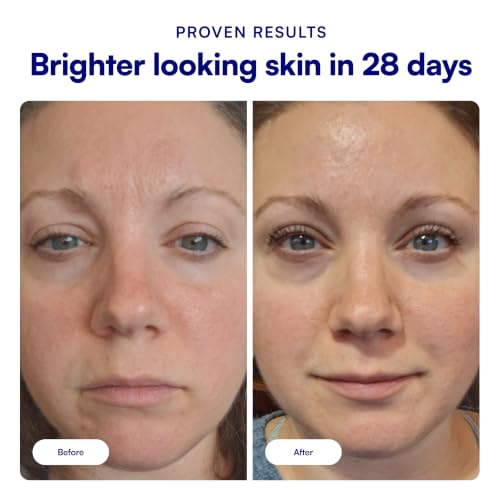 Bliss Bright Idea Vitamin C Brightening Face Serum - 1 Fl Oz - - Product Imagery