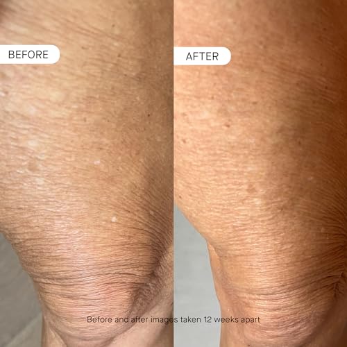 OneSkin OS-01 BODY Topical Supplement Moisturizer | Age - Product Imagery
