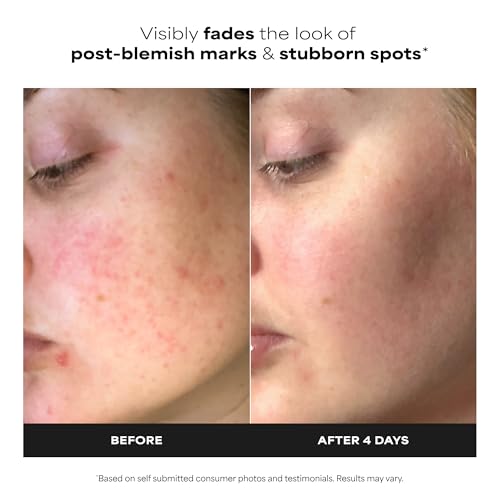 Paula's Choice BOOST 10% Azelaic Acid Booster Cream Gel, 1 Fl Oz - Product Imagery