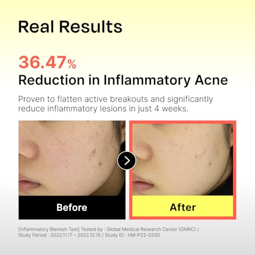 Celladix Sebum Rebalancing Rx 131 Ampoule | Pore Clearing Serum - Product Imagery