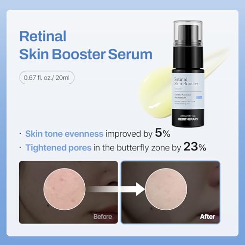 MEDITHERAPY Gentle Boost Kit – Korean Skin Care Set with Retinal - Product Imagery
