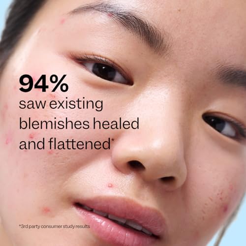 Peach Slices - Acne Exfoliating Toner (4.05 oz) - 2% Salicylic - Product Imagery