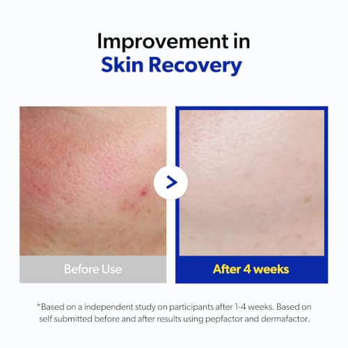 Pepfactor 23% Growth Factor Barrier Recovery Serum - Product Imagery