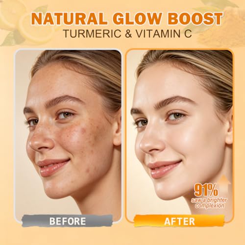 Turmeric Wash and Care 4 Piece Set,Turmeric Skincare Set: - Product Imagery