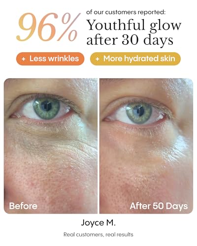 FRØYA Organics Hyper Potent Dark Circles & Bag Eye Balm (0.5 oz) - Product Imagery