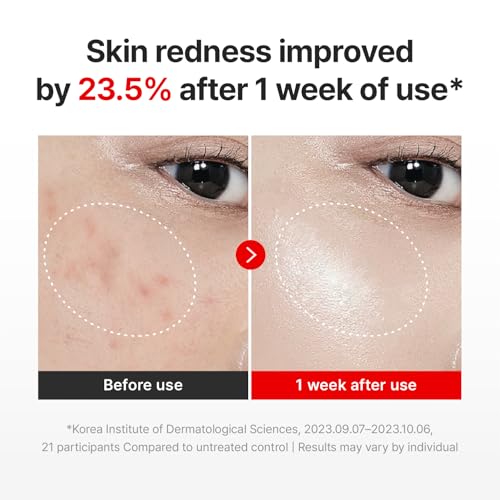 CENTELLIAN 24 Madeca Cream Time Reverse, TECA Moisturizer - Product Imagery