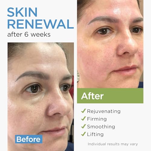 Collagen Face Cream with Stem Cells Retinol Hyaluronic Acid 1.7Oz - Product Imagery