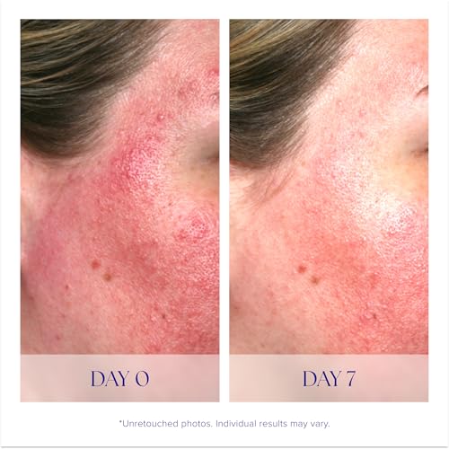 iS CLINICAL Pro-Heal Serum Advance+, Antioxidant-Rich Vitamin C - Product Imagery