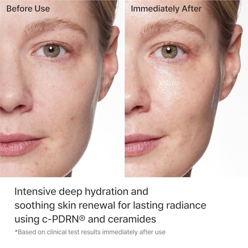 REJURAN Turnover Mask, c-PDRN® Face Mask, 5ea x 1.35 fl oz - Product Imagery