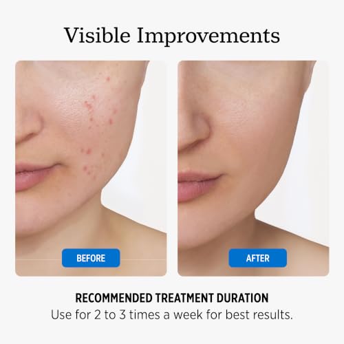 NUVADERMIS 35% Glycolic Acid Peel Pads – Exfoliating Facial - Product Imagery