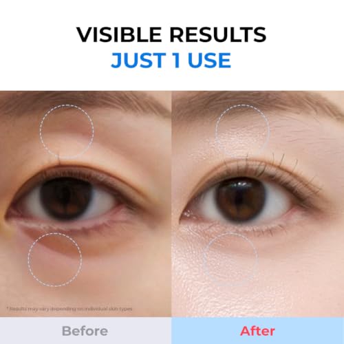 DEWYCEL BabyCollagen Hydro Gel Mask | 2-Step Gel Face Mask for - Product Imagery