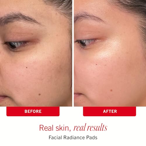 First Aid Beauty Sensitive Skin Skincare Routine Set, 3-Piece - Product Imagery