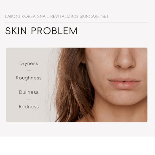 Korean Snail Essence Skin Care Kit,Skincare Gifts for - Product Imagery