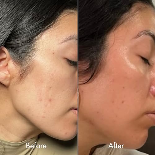 Kopari Moisture Whipped Ceramide Cream | Hydrate and Restore | - Product Imagery