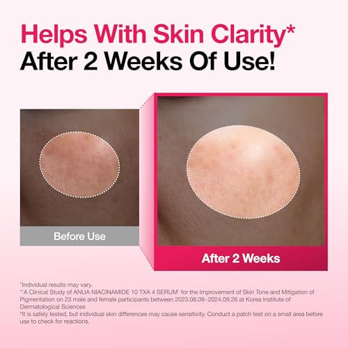 Anua Niacinamide 10 + TXA 4 Serum, Korean Skincare, 1.01 fl.oz | - Product Imagery