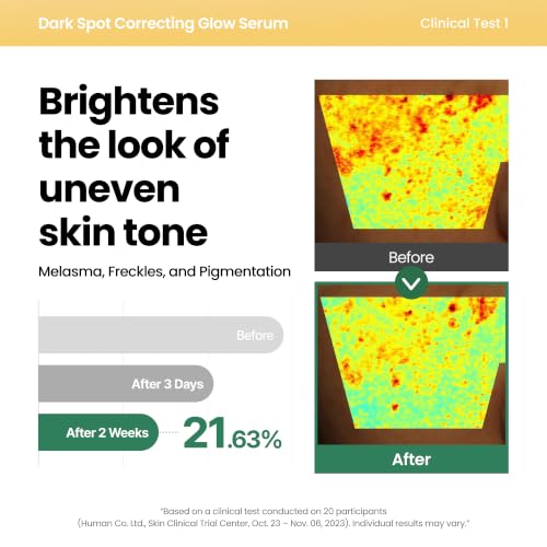 AXIS-Y Dark Spot Correcting Glow Serum - 5% Niacinamide Dark - Product Imagery