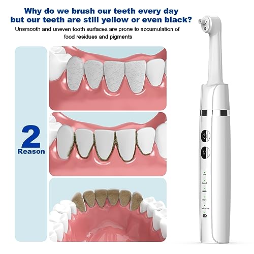Tooth Polisher,Teeth Polishing Kit for Daily Cleaning,Polishing - Product Imagery