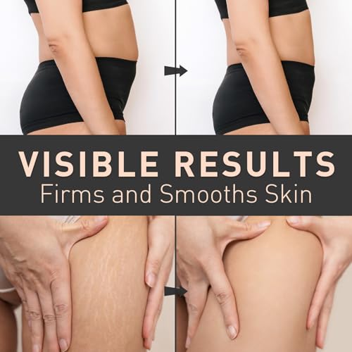 Enaskin Naturals Belly Firming Cream: B Flat Skin Tightening, - Product Imagery