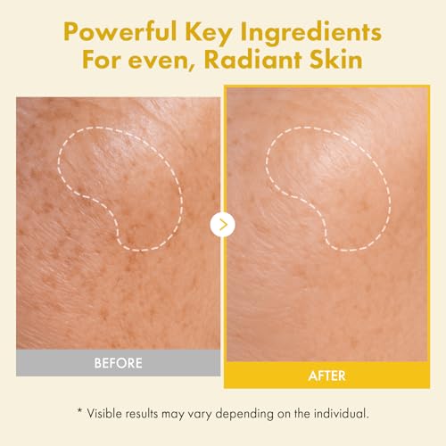 TOSOWOONG K-Beauty Viral Glass Skin Mask Trio - Real Collagen - Product Imagery