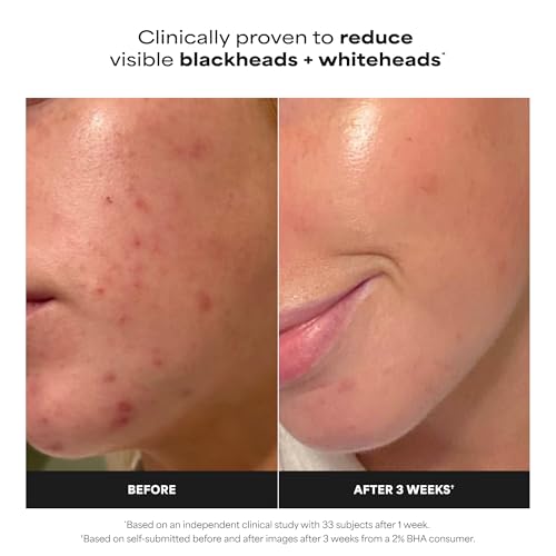 Paula's Choice SKIN PERFECTING 2% BHA Liquid Exfoliant - Product Imagery
