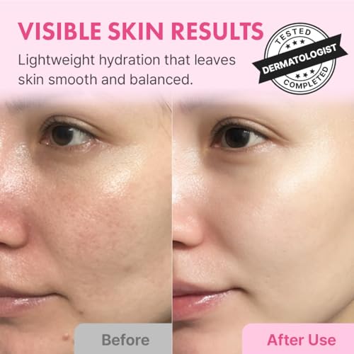 Hanskin Hyaluron Skin Essence, Hyaluronic Acid Toner, Dry Skin, - Product Imagery