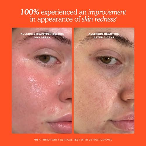 Tower 28 SOS Recovery Hydrating Face Cream for Sensitive Skin - Product Imagery