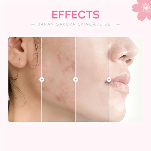 Skin Care Set, Cherry Facial kit for women, Skincare Kit Gifts - Product Imagery
