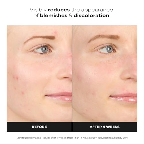 Paula's Choice BOOST 10% Azelaic Acid Booster Cream Gel, 1 Fl Oz - Product Imagery
