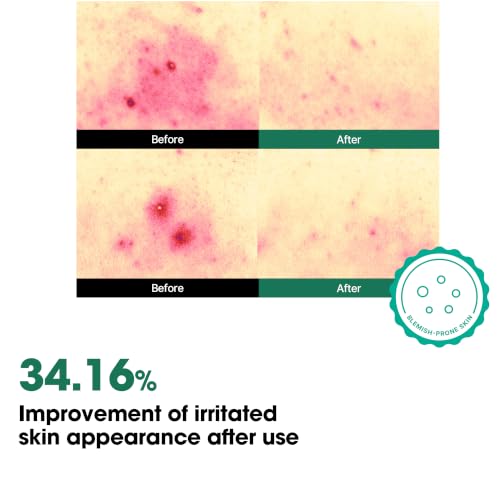 SOME BY MI AHA BHA PHA 30 Days Miracle Body Toner Mist – 4.73oz, - Product Imagery