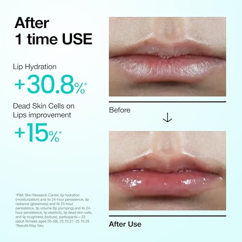 Anua PDRN Lip Serum, 0.33 fl.oz - Product Imagery