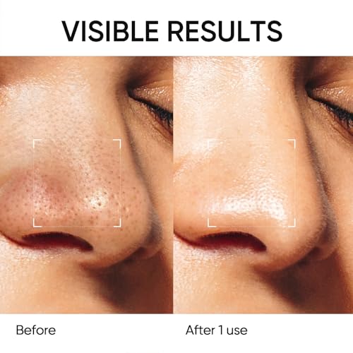 SKINTIFIC Deep Pore Cleansing Blackhead Remover Face Mask Stick, - Product Imagery
