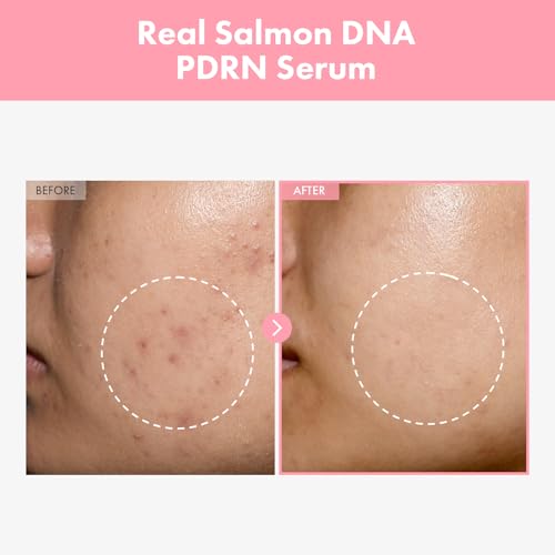 TOSOWOONG Pink Peptide 12 PDRN Serum for Firming & Glass Skin, - Product Imagery