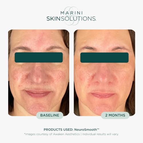 Marini SkinSolutions NeuroSmooth - Neuromodulating, - Product Imagery