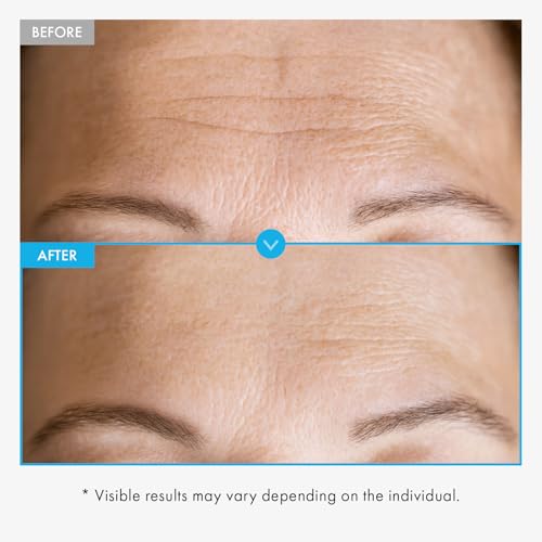 TOSOWOONG Copper Peptide Face Serum, Anti-Aging for Fine Lines, - Product Imagery