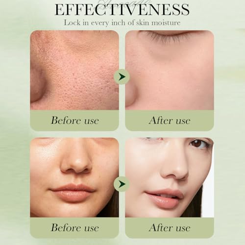 7pcs Avocado Skincare Kit, Skin Care Gift Set with Facial - Product Imagery