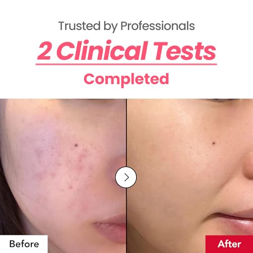 Dark Spot 24% Correcting Pink Glow Cream | Tranexamic Acid 6%, - Product Imagery