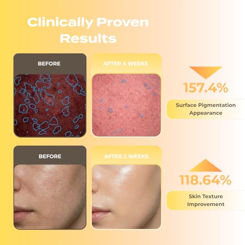 Microneedling Serum with Salmon DNA PDRN Shots - Resurfacing - Product Imagery