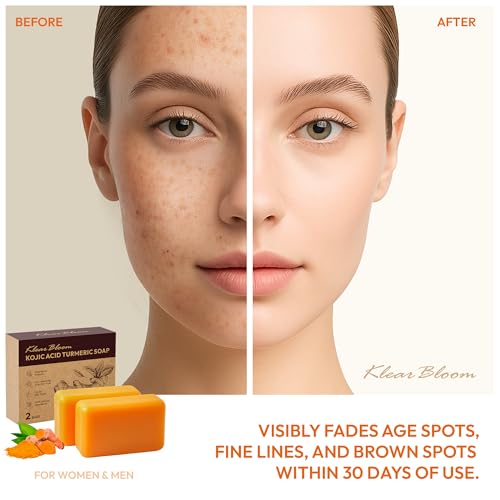 Kojic Acid Soap, Turmeric Soap Bar for Dark Spots Brightening & - Product Imagery